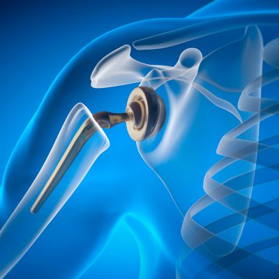 Estrategias actuales en el manejo de las infecciones osteoarticulares